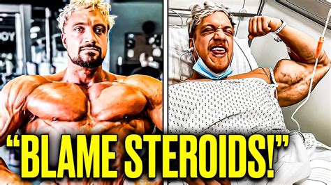 what steroids does joesthetics take